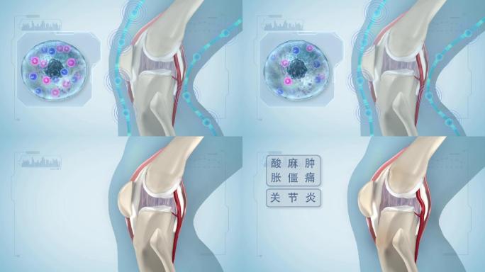 细胞缺失经络不通关节膝盖水肿