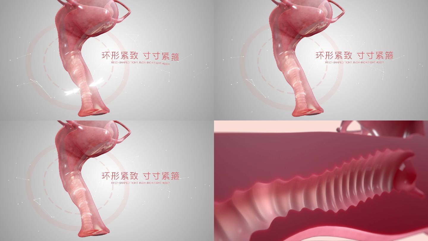 阴道紧致卵巢生殖保健模板