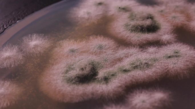 真菌及霉菌正面及反面挑细菌