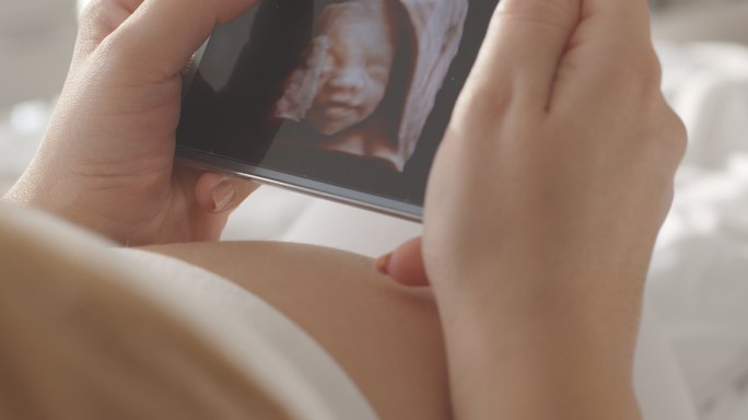 孕妇在智能手机上观看超声图像