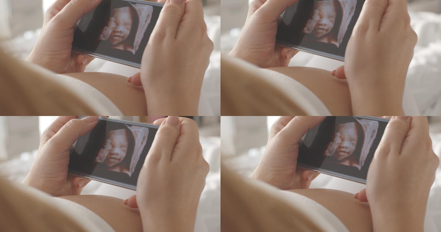 孕妇在智能手机上观看超声图像