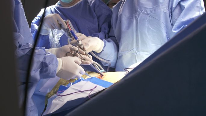 腹腔镜肺外科外科手术抢救病人手术室