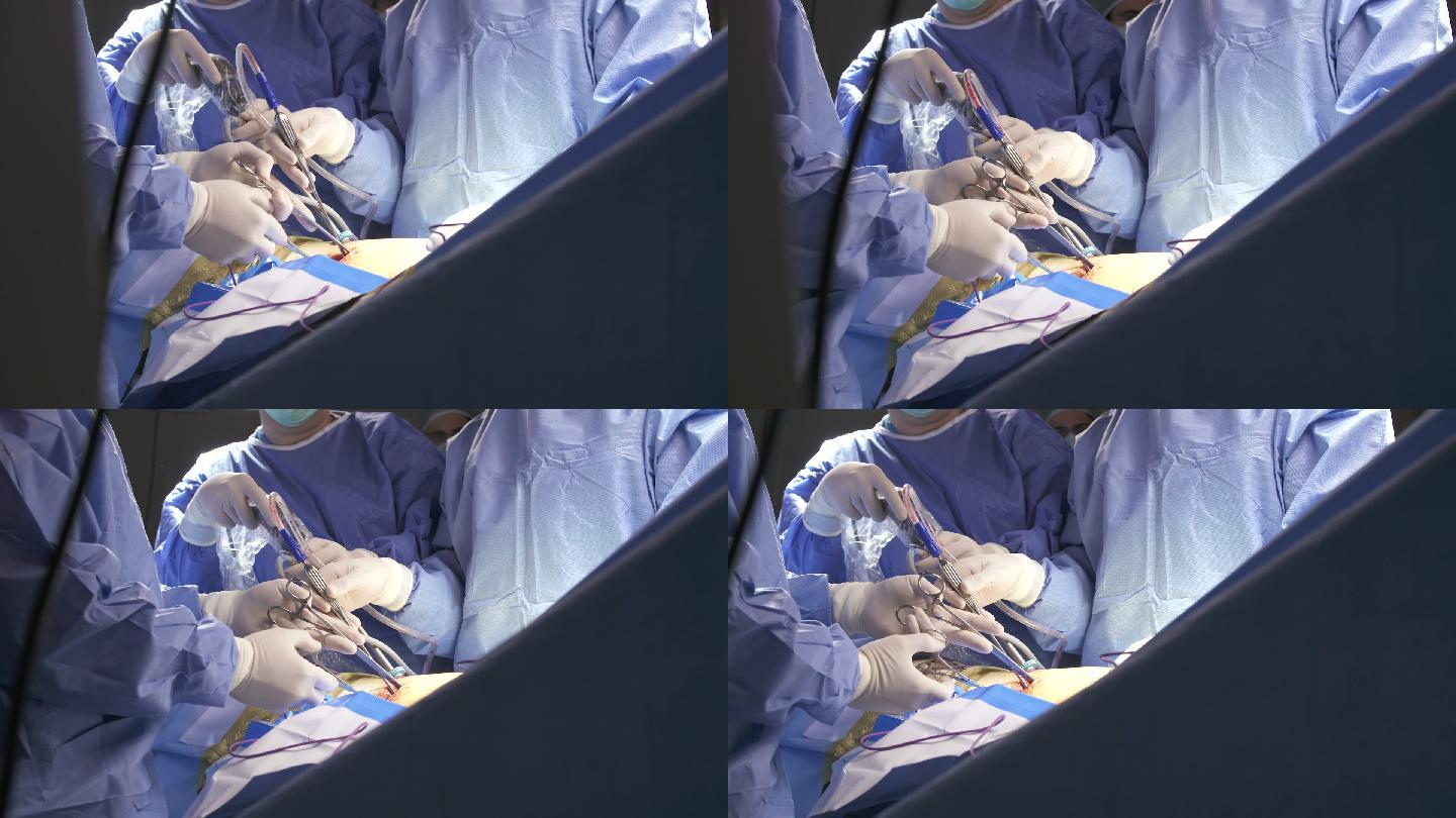 腹腔镜肺外科外科手术抢救病人手术室
