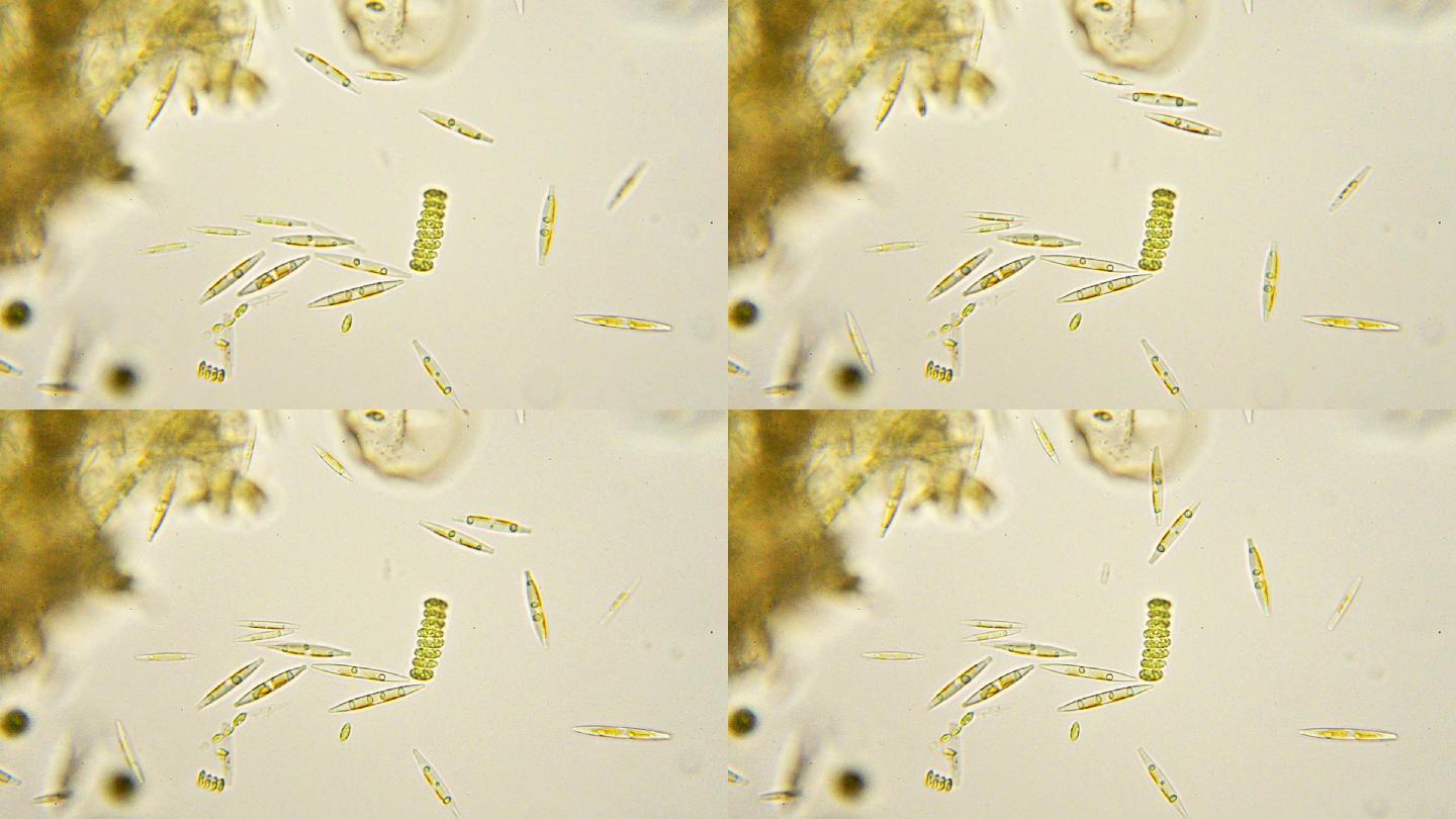 硅藻显微照片