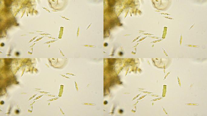 硅藻显微照片