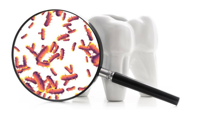 牙齿周围的细菌牙疼洗牙医院专家口腔卫生