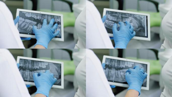 牙科医生在数字平板电脑上看人的牙齿X光片