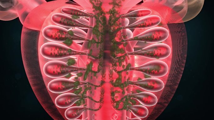 前列腺阀门结构积留毒素代谢物质于腺管内