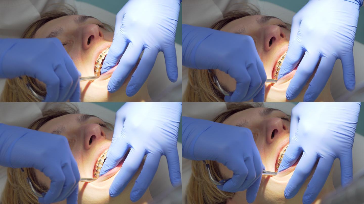 牙科诊所戴牙套的年轻女子