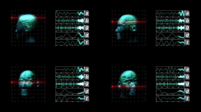 脑扫描显示器脑电波脑机互联脑部扫描大脑数