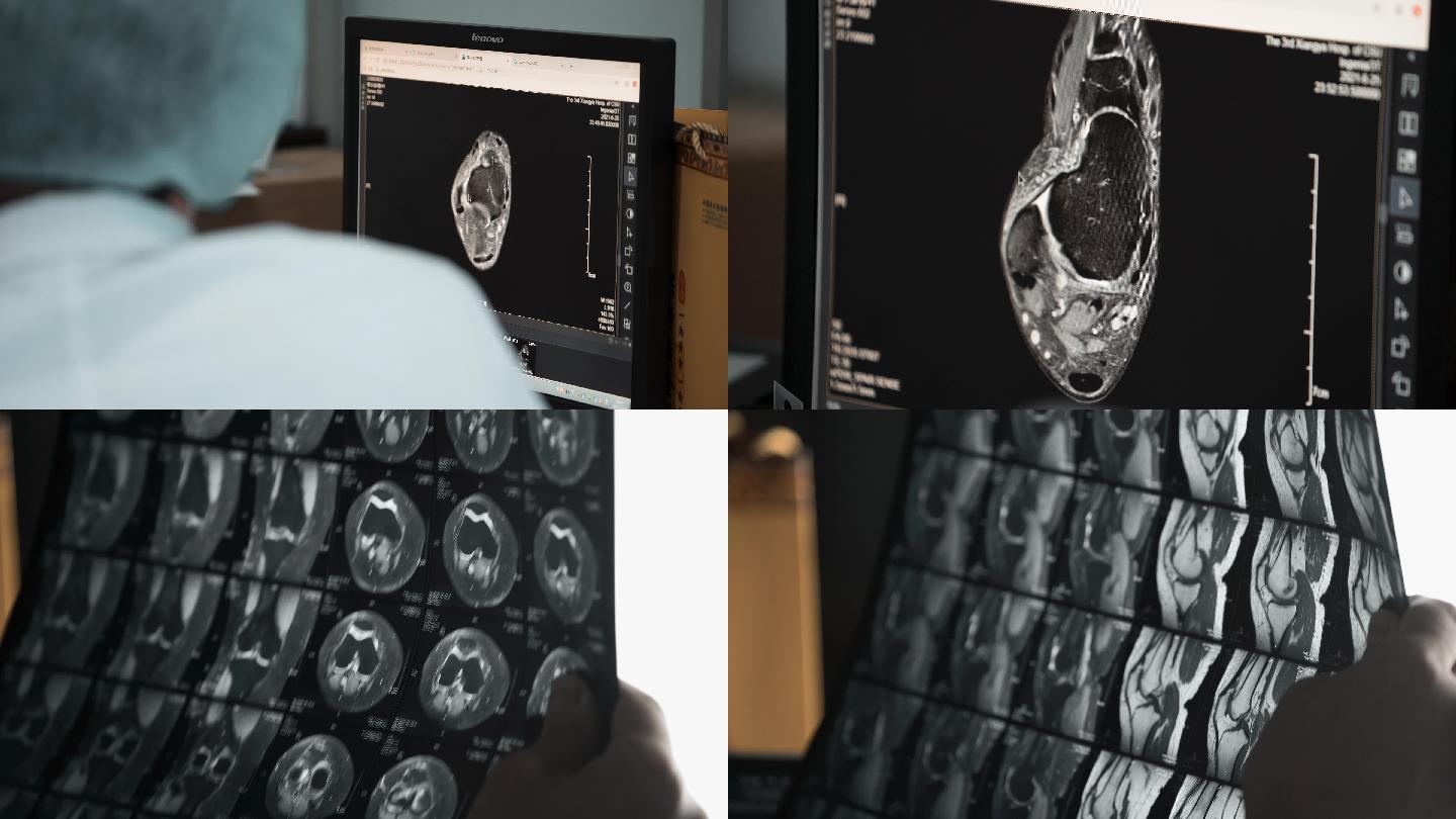 4K医生看CT结果诊断空镜