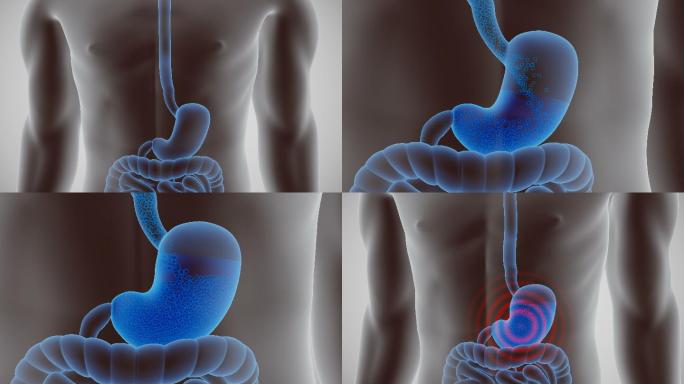 胃胀治疗胃病奥美拉唑药物