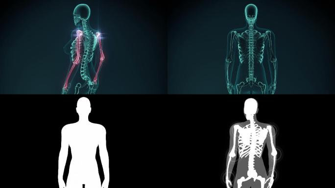 手臂、肩膀疼痛的3d渲染插图。