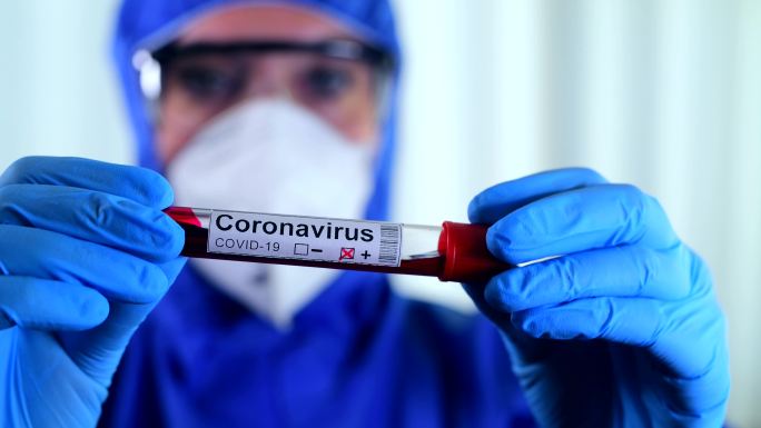 冠状病毒covid19检测新的冠状病毒