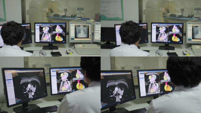 病人医生做核磁脑CT心血管