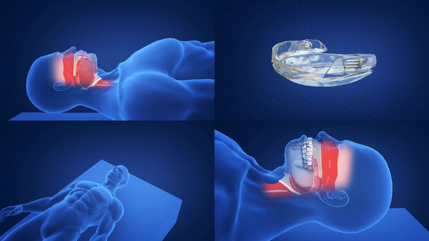 人体打鼾三维医学原理动画