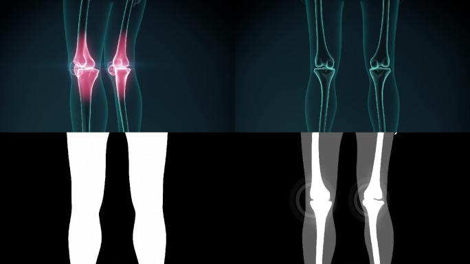 膝盖疼痛动画。疼痛脊柱-身体部分分析