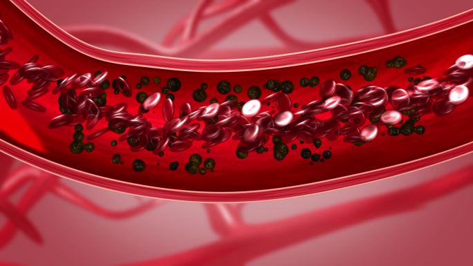 血管垃圾堆积影响血流血压
