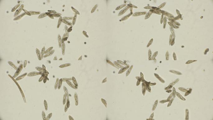显微镜下的菌落螨虫寄生虫细胞壁