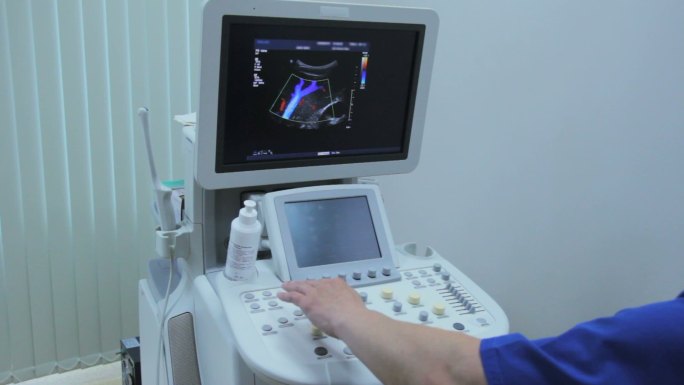 超声机器上显示图形和肾动脉