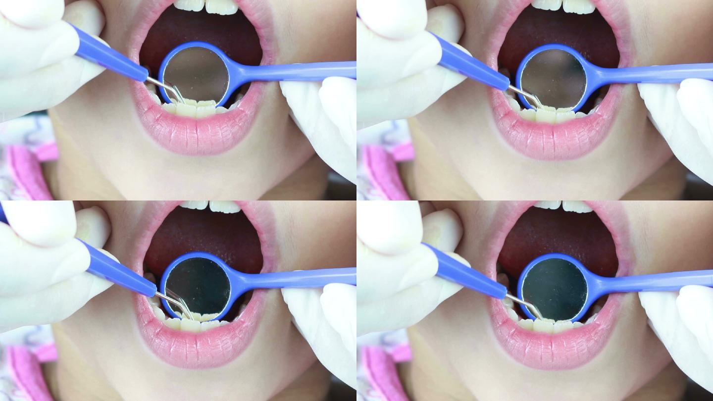 牙医清洁牙齿和检查