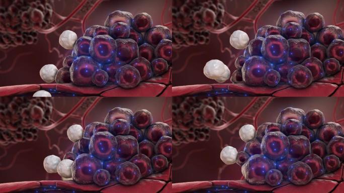 破坏肿瘤细胞3D动画