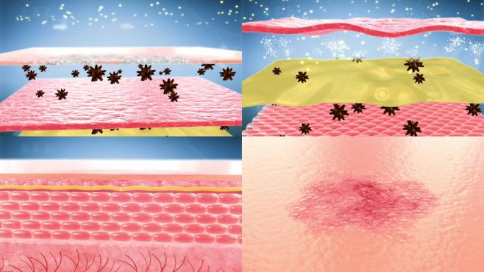 修复皮肤组织  痤疮  皮肤问题 痘痘