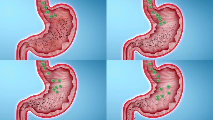 胃内垃圾毒素有害菌排除体外