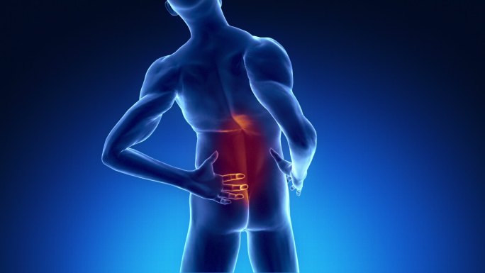 x光视野中的背痛腰肌劳损腰酸背痛三维动画