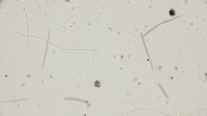 显微镜下的水母盲蝽微生物
