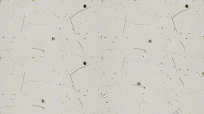 显微镜下的水母盲蝽微生物