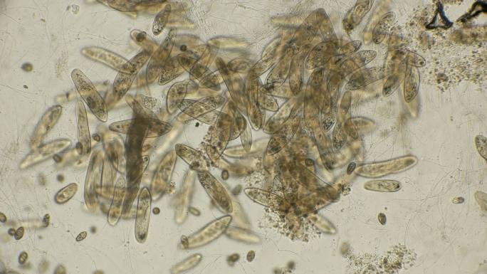 显微镜下的大菌落副滴虫