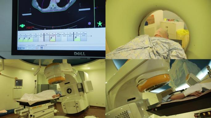 脑ct 放射治疗 医院 医疗 室内