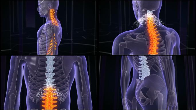 治疗背痛的抽象粒子动画。