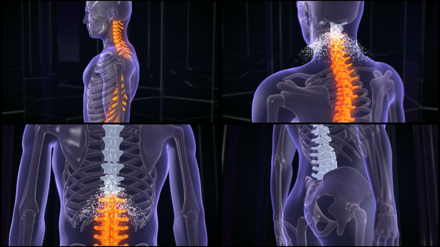 治疗背痛的抽象粒子动画。