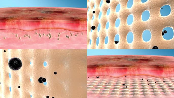超强渗透因子治疗皮肤病