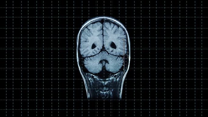 脑前磁共振扫描视觉皮层图像医疗保健和医学