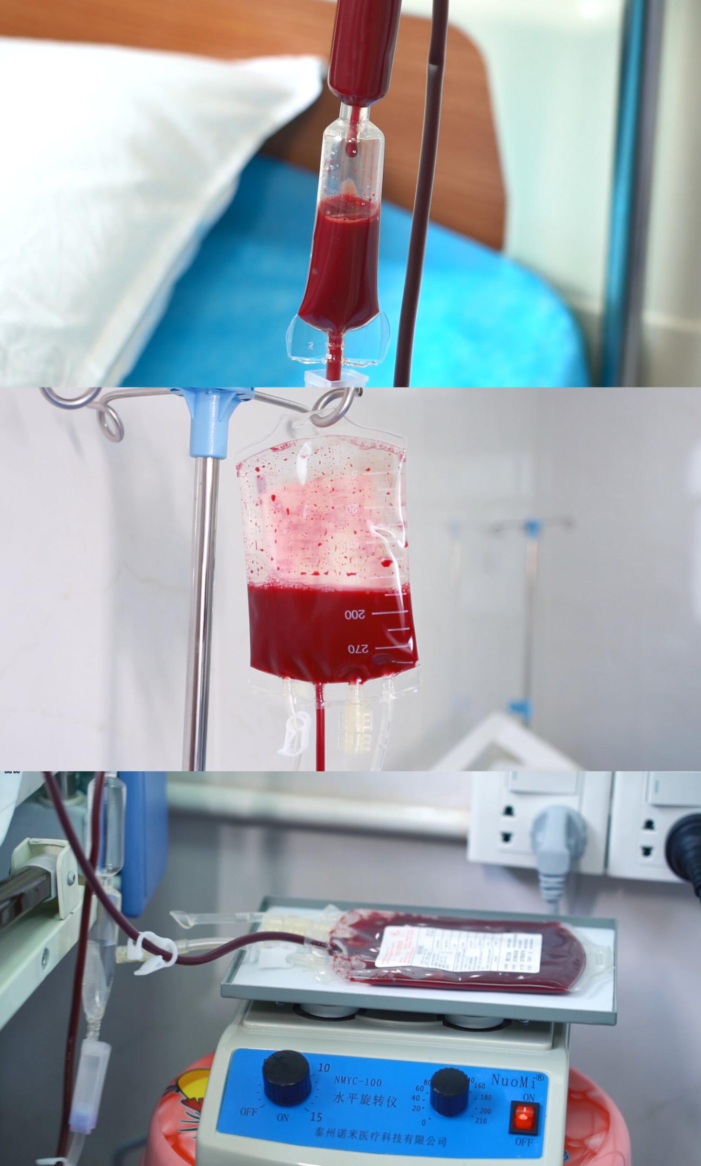 医院血液输血疗法