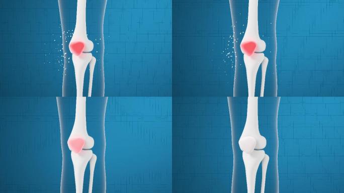 腿部膝盖骨骼与药物吸收 3D渲染