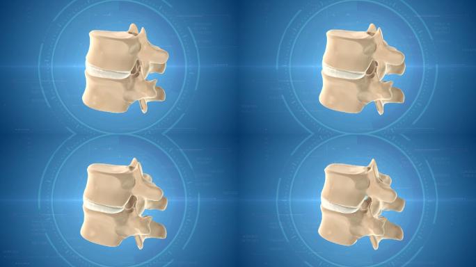 椎间盘缓解压力