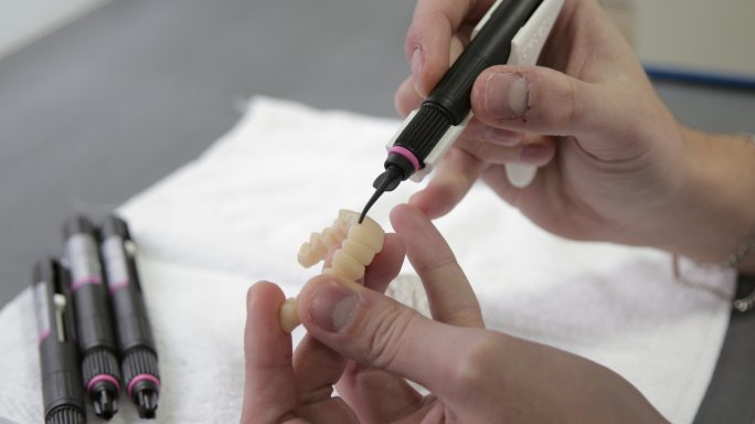 牙科技师在3D模型上应用牙齿升级