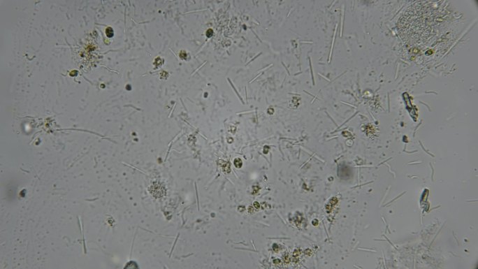显微镜下杆状细菌