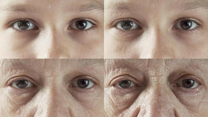 人变老的特写镜头变老皱纹变化衰老皮肤老化