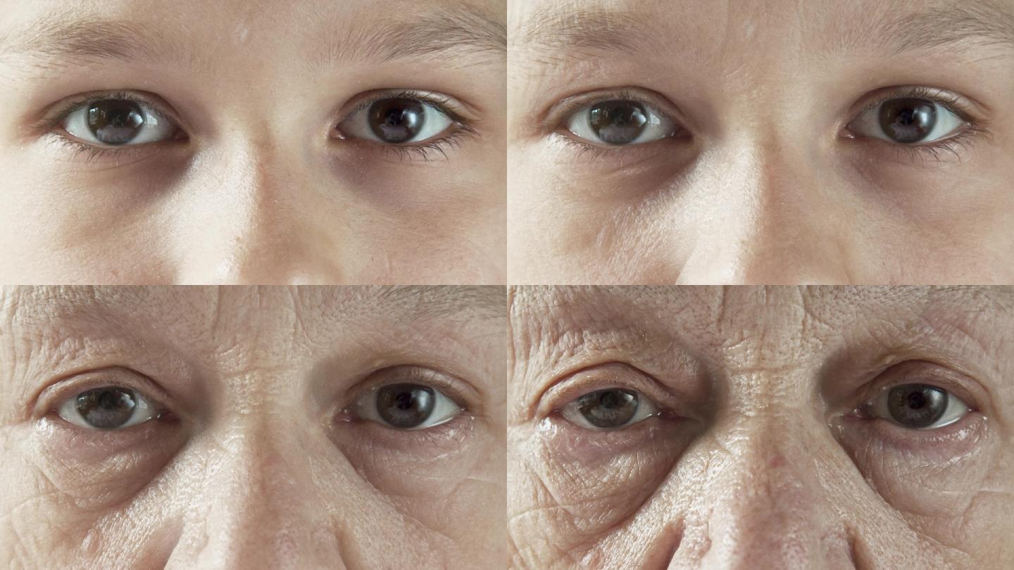 皱纹和肌肤老化 – Health123