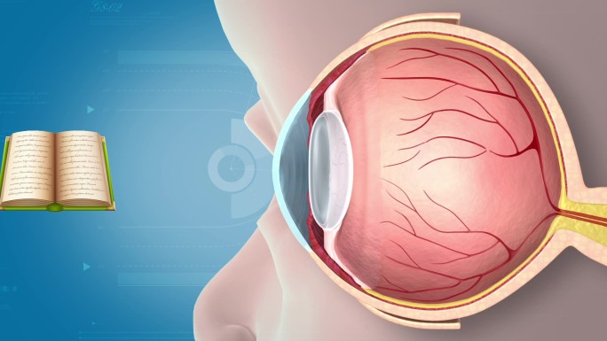 近视眼形成原理