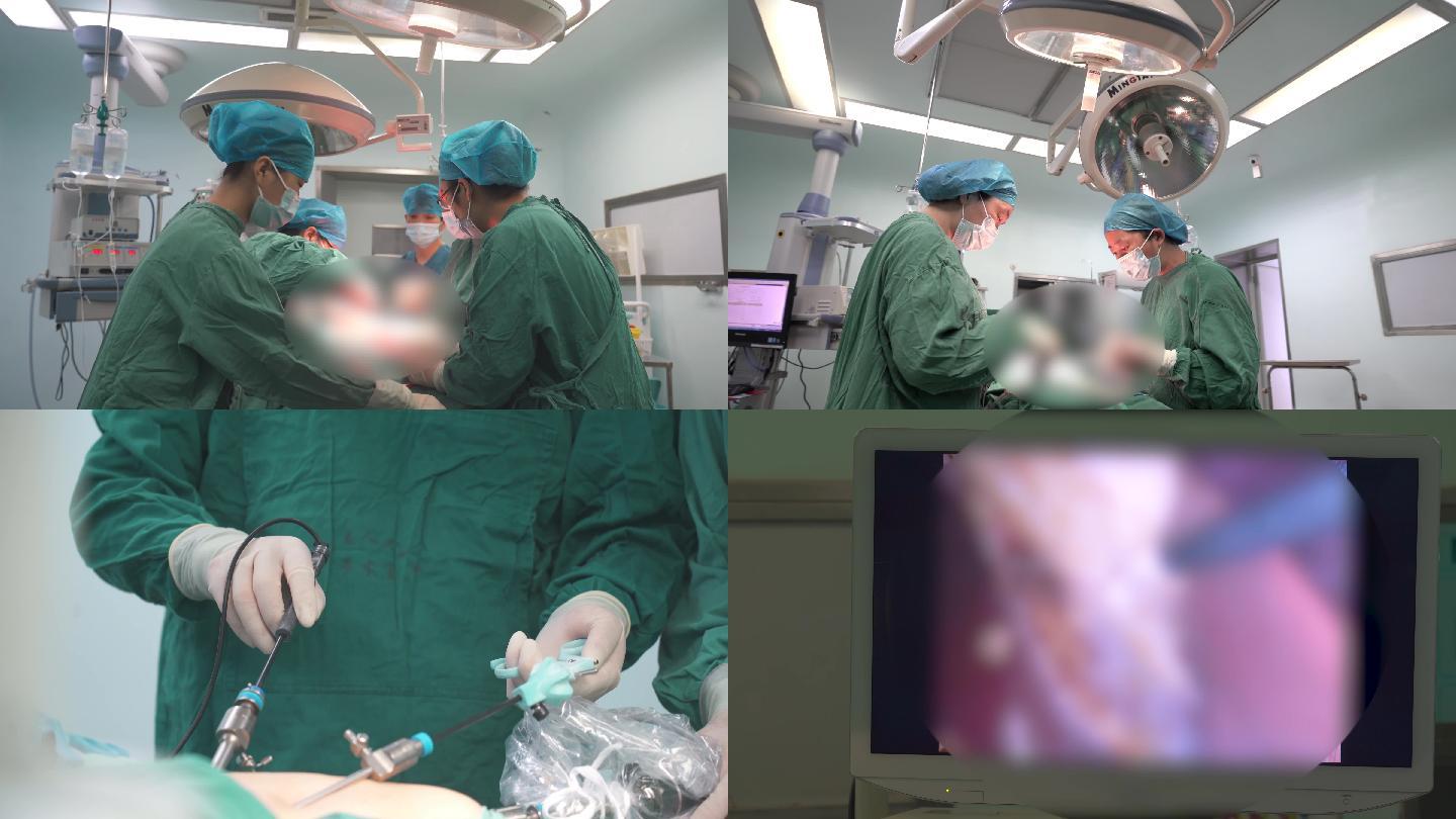 手术室手术腹腔镜手术