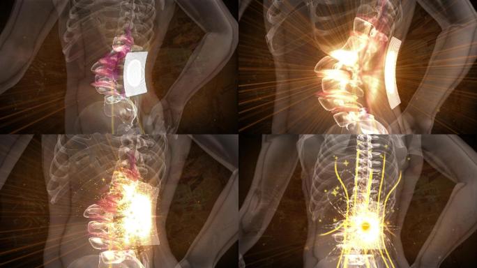 腰椎贴药力在稀土磁作用下打通经络穴位通道