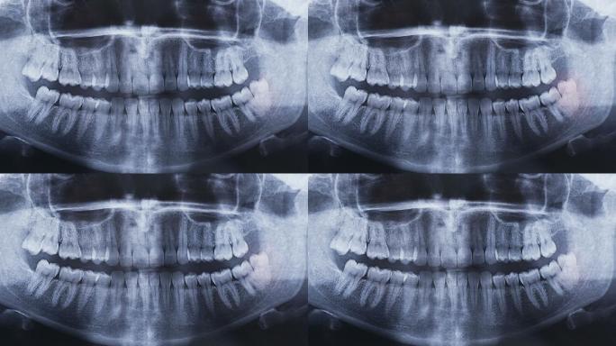 牙科全景X线图像医疗诊所医疗保健和医学
