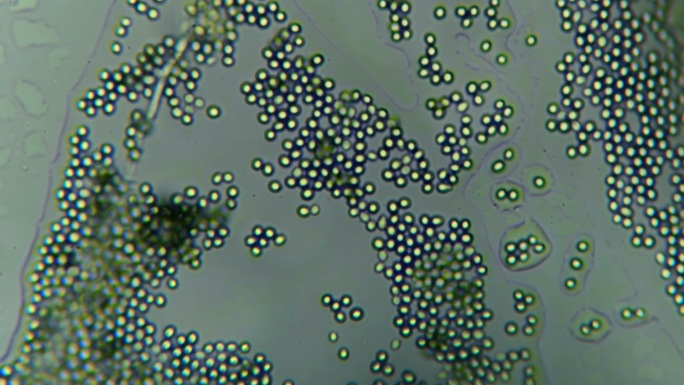 显微镜下的霉菌