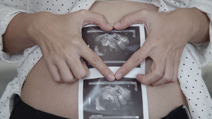 孕妇手拿三维超声图像